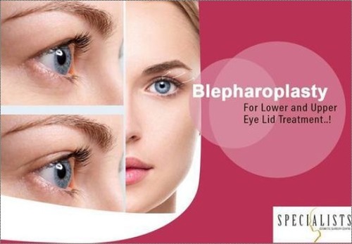 Blepharoplasty Surgery Services Application: Lab Use