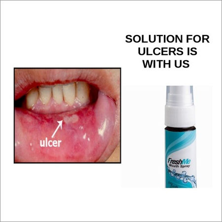 Mouth Ulcers Spray