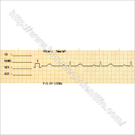 ECG Machine