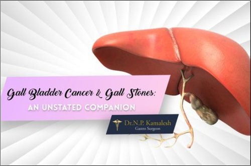 Gall Bladder Cancer Treatment Services