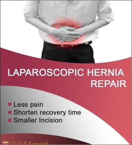 Laparoscopy Hernia Repair Treatment Services
