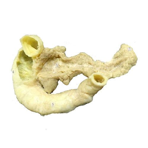 Natural Human Pancreas And Duodenum Plastinated Body Exhibits