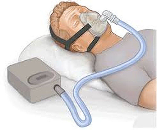 Electronically Operated Cpap Machine