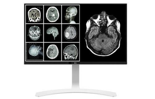 100% Accurate With The Minimum Error Computed Tomography Monitor Application: Laptop