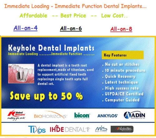 Same Day Keyhole Basal Dental Implant Treatment Service