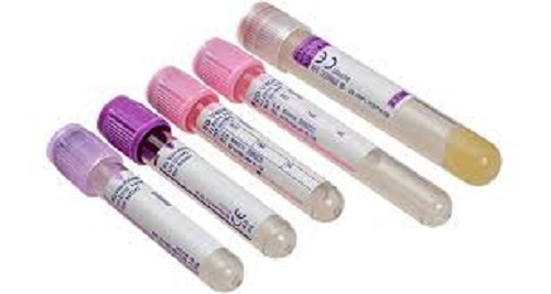 मल्टी कलर लाइट वेट और ट्रांसपेरेंट ब्लड कलेक्शन ट्यूब