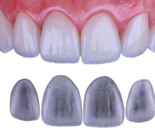 Dental PFM Crown
