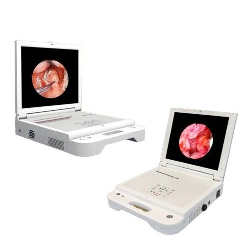 Endoscopy Portable Camera System Application: Medical