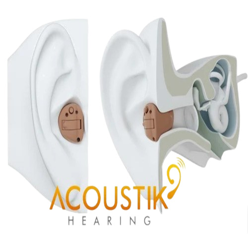 Clear Voice Noise Reduction Acrylic Cic Hearing Aid