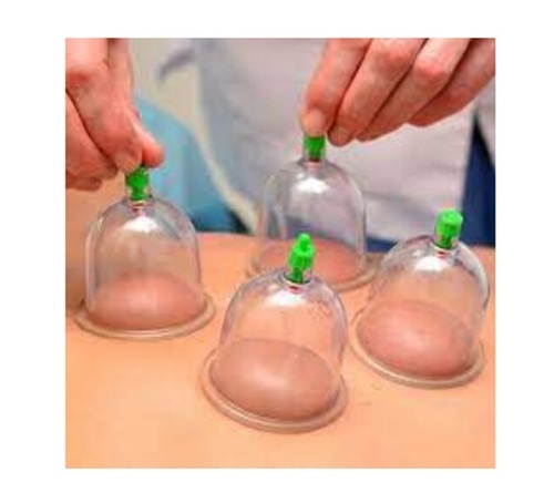 Cupping Massage Physiotherapy Services