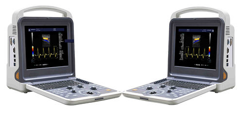 YJ-U60PLUS Color Doppler AcA A AcA A Full Digital Color Doppler Ultrasound Diagnostic System