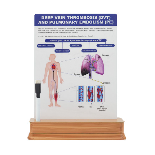 1 Slide on Stand - Deep Vein Thrombosis and Pulmanary embolism