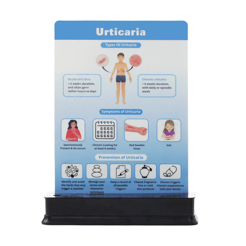 Urticaria Educational Chart - Rectangular ABS Plastic, Portable Stand for Patient Education and Doctor-Patient Discussions