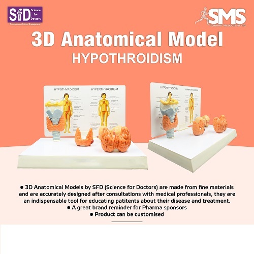 3D Anatomical Model - Hypothroidism