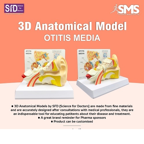 3D Anatomical Model - Otitis Media