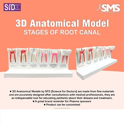 3D Anatomical Model - Stages of Root Canel