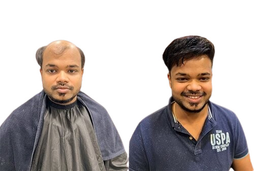 Hair Wig - Color: Natural Brown