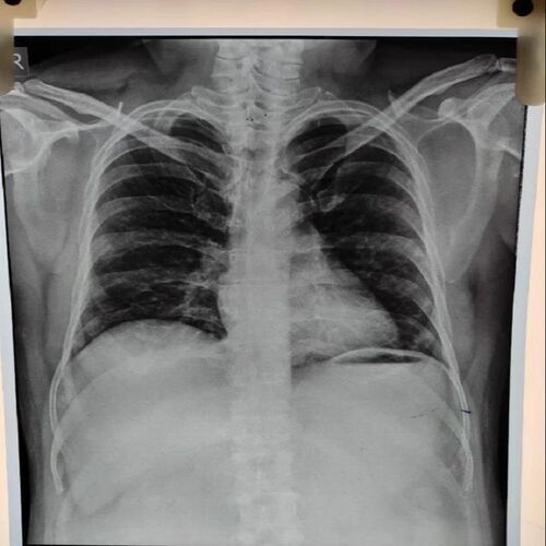X Ray Film