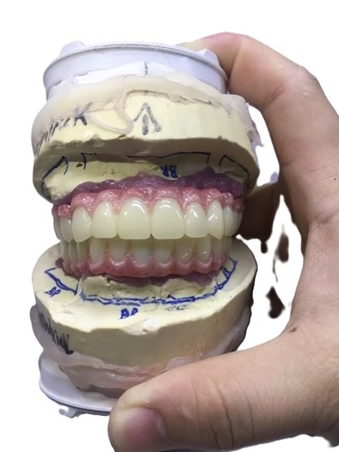 Dental Implant Bar