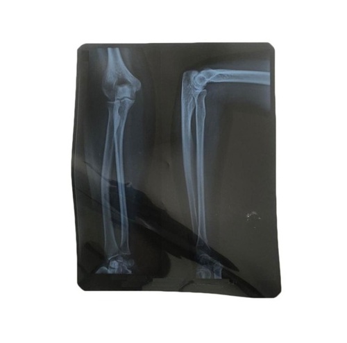 X Ray Films