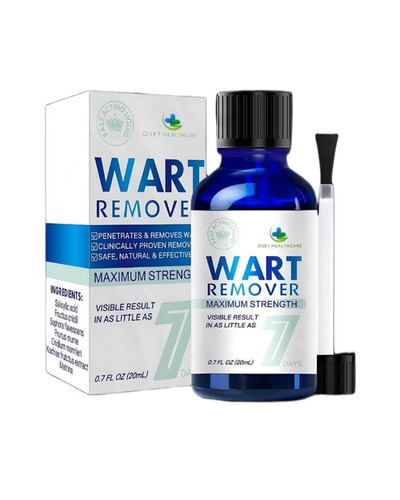 Wart Remover