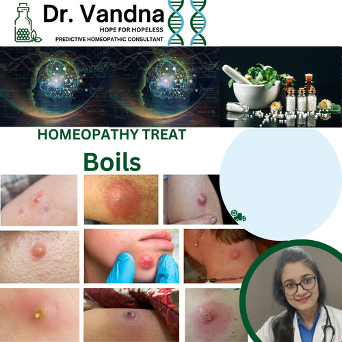 Online Skin Boils Homeopathy Treatment