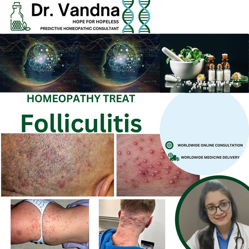 Online Skin Folliculitis Homeopathy Treatment