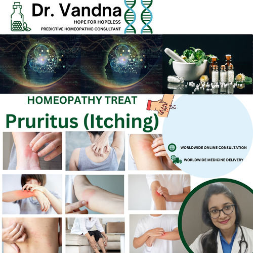 Online Skin Pruritus Homeopathy Treatment