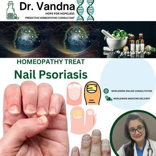 Online Skin Nail Psoriasis Homeopathy Treatment