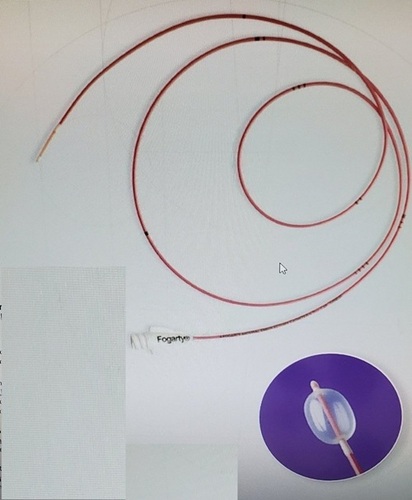 Fogarty Embolectomy Catheter