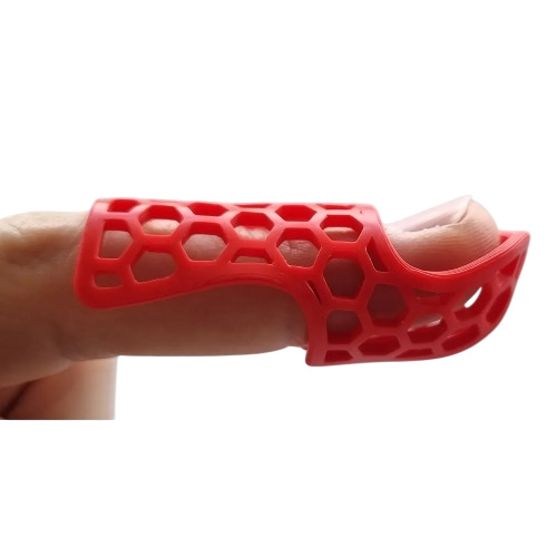 Finger Expension Splint