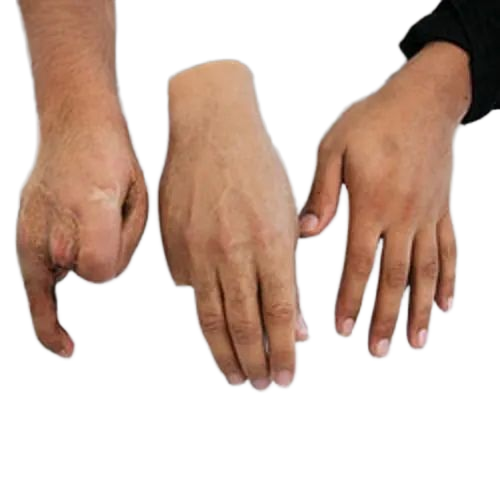 Silicone Prosthesis Hand