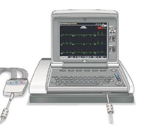 Ecg Machines