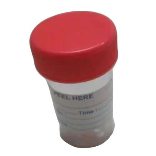 Plastic Urine Container