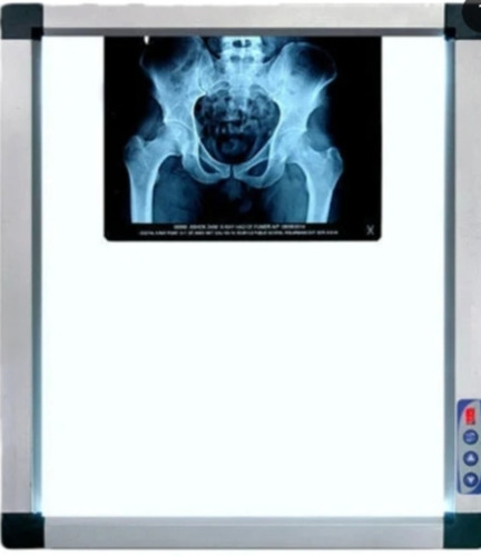 Led X Ray View Box
