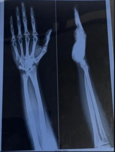 Blue Inkjet X Ray Medical Film