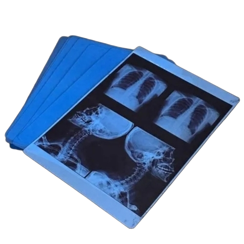 Medical Inkjet X Ray Films 8x10 - Polyester 8x10 Blue, Inkjet Compatible, Sharp Contrast, Fast Drying, Waterproof