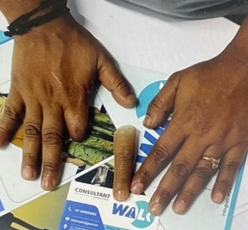 Artificial Index Finger - Color: Skin-Tone