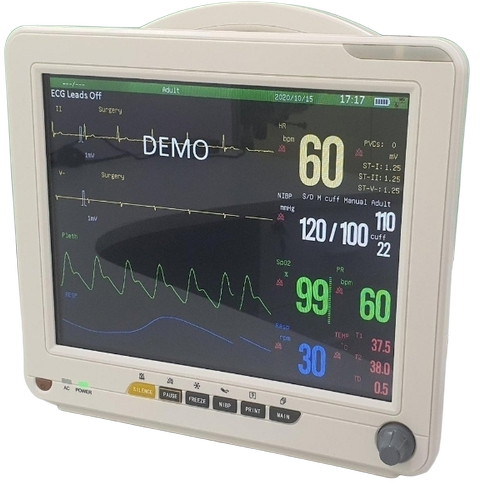 Patient Monitor