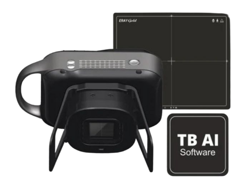 Handheld Portable X Ray Machine With Tb Ai Software - Focus: 0.4-0.8 Mm