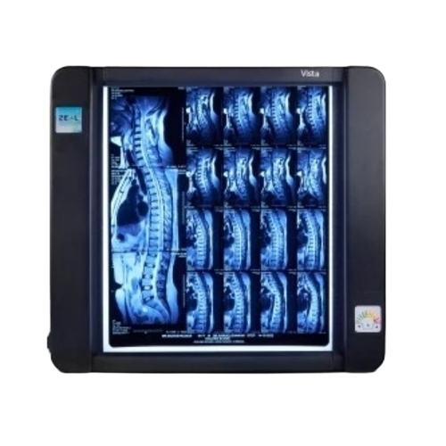 Led X Ray Film Viewer