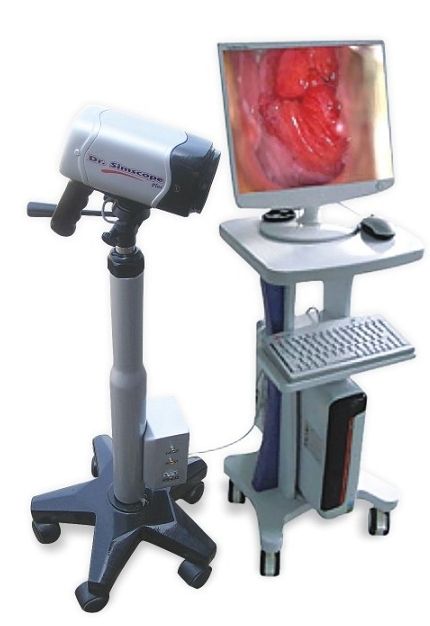 Digital Video Colposcope