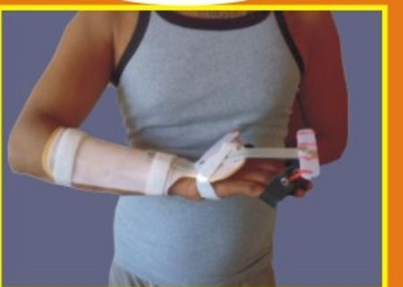 Palsy Splint (Fix Wrist)