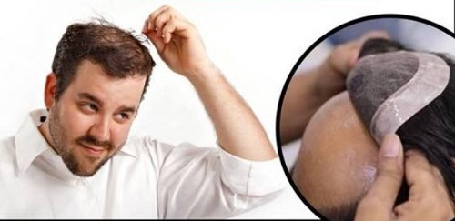 Hair Patch For Men - Natural Human Hair 10-20 Inch Length Curly Style | Hand Tied Easy Fit Shiny Look Skin Friendly