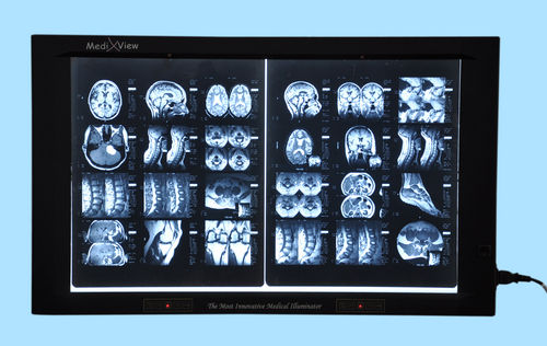 Digital 2 Film X-ray Illuminator with film sensor