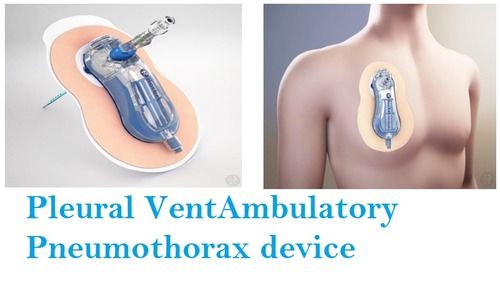 R54565 Pleural VentAmbulatory Pneumothorax Device