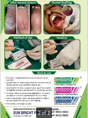 Soft On Tissue Sutureless, Painless, Scarless Wound Closure Surgical Glue Grade: Medical