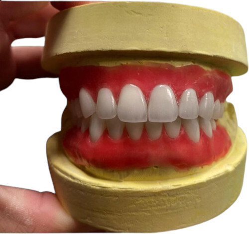 Aesthetic Dental Crown