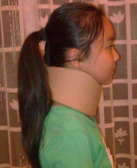 सर्वाइकल कॉलर