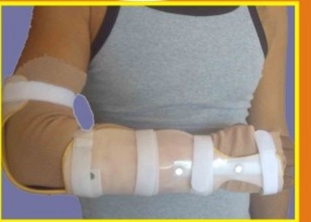 Igr Forearm With External Support